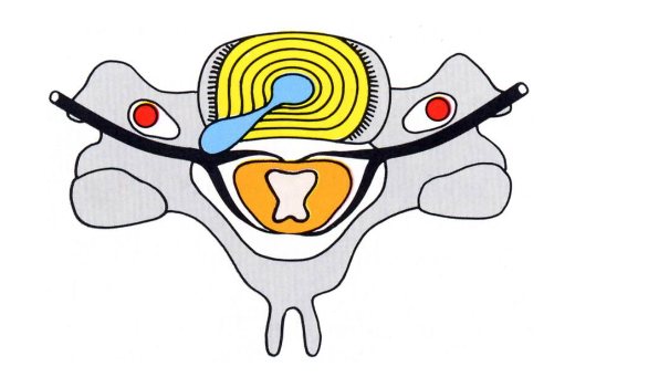 Anatomie du disque intervertébral cabinet vertika